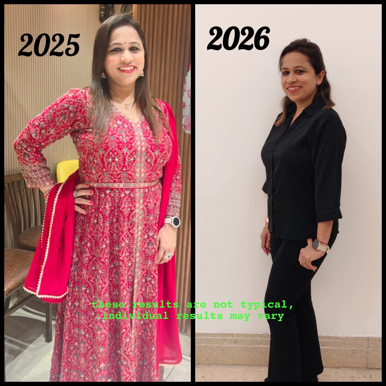 2025 vs 2026 Transformation