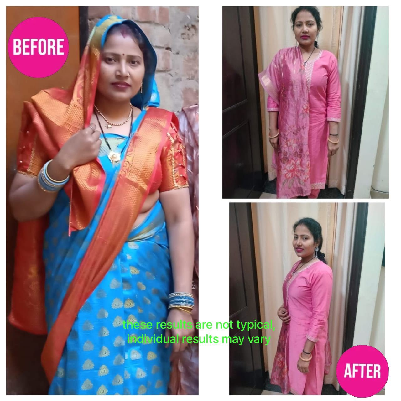 Side and Front View Transformation